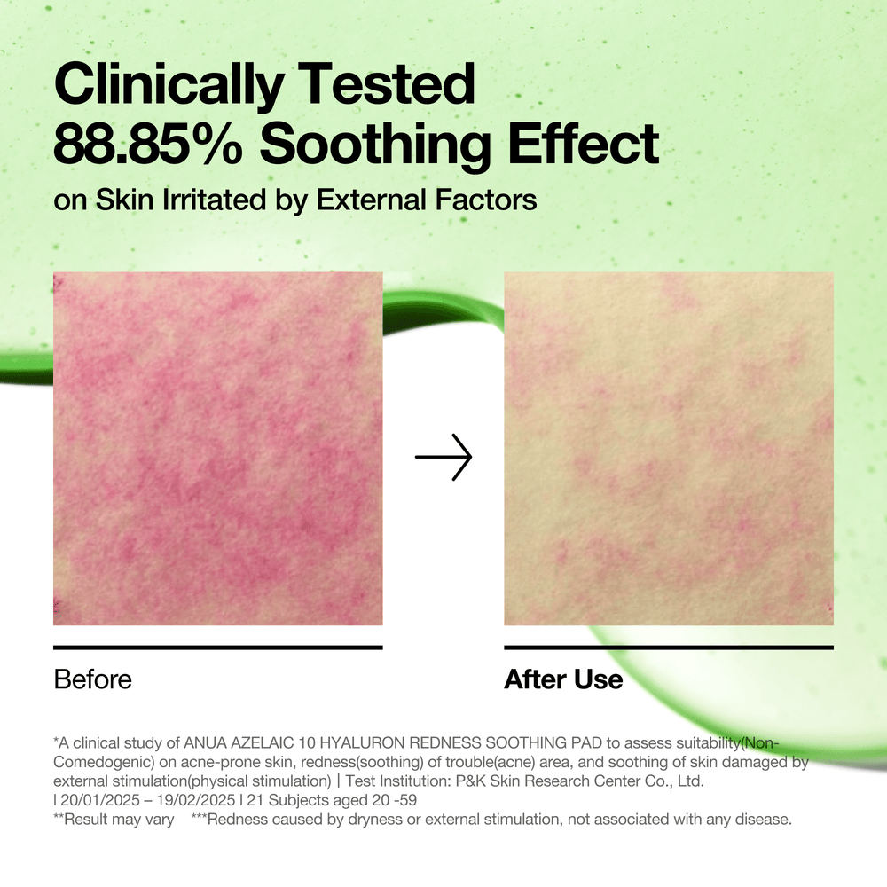 Anua Azelaic 10 Hyaluron Redness Soothing Pad 230ml 90 Pads